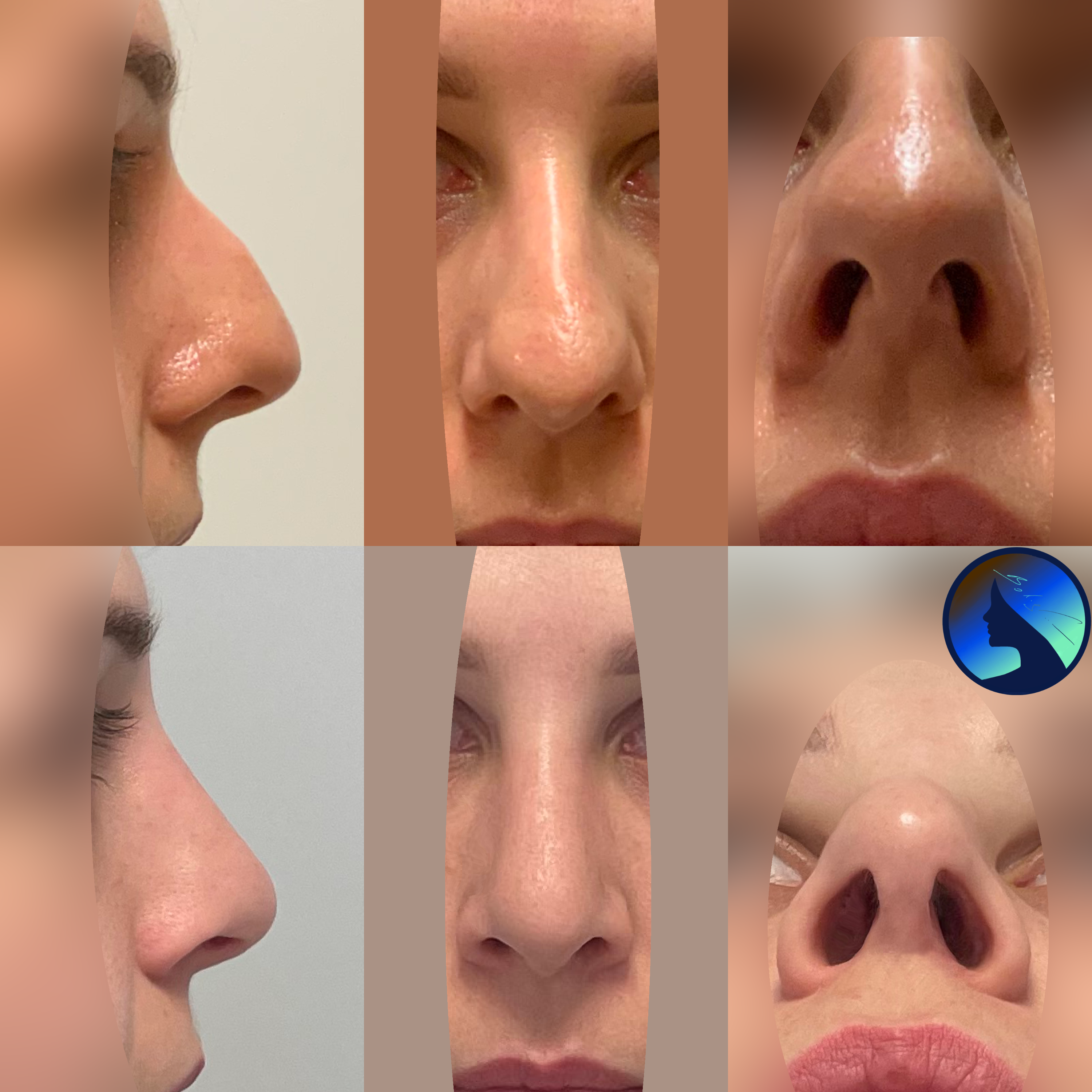 Nose for video