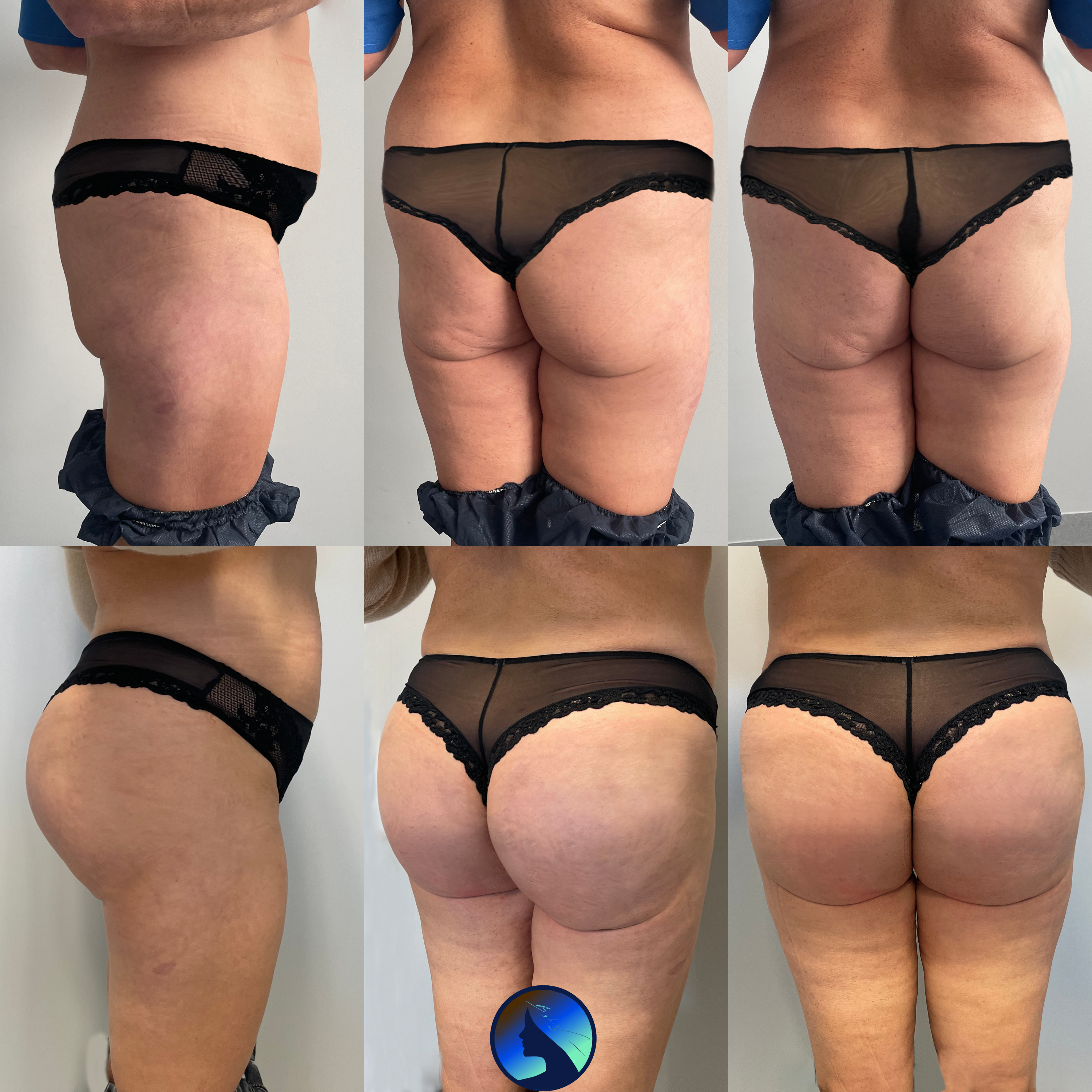 a very beautiful Butt