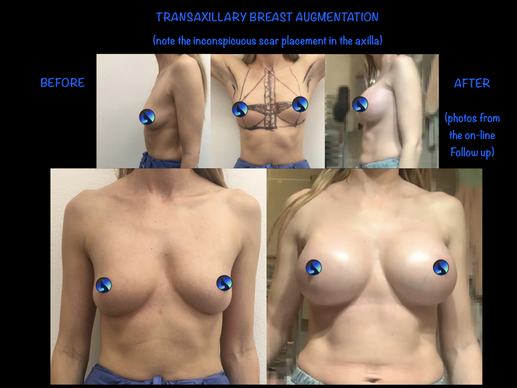 transaxiliary on line